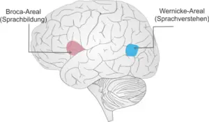 L&auml;sionsort Broca Ahasie