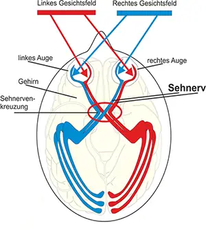 Sehnnervkreuzung