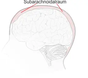 Subarachnoidalraum