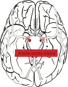 Arteria carotis interna